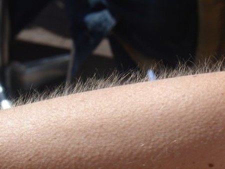 ¿Por qué se nos pone la carne de gallina cuando escuchamos determinadas canciones?