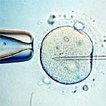 Se admite la selección genética de embriones con fines terapéuticos