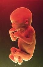 ¿Deben los médicos luchar para sacar adelante a un bebé que ha nacido tras 22 semanas de gestación?