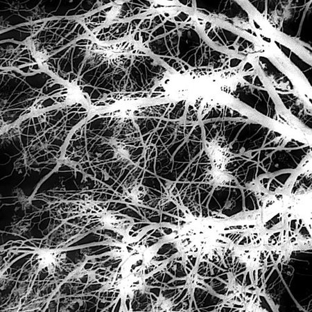 Neuronas protegidas de la muerte celular