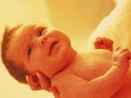 Ictericia en recién nacidos