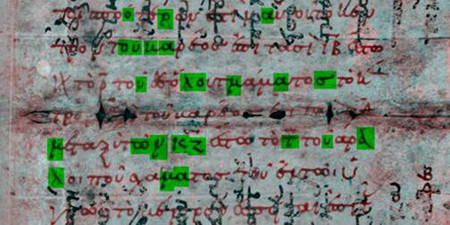 Imaging Ocr1
