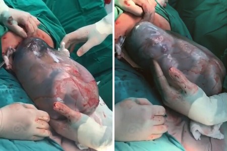 Impresionante vídeo viral de un parto velado en el que el bebé nace dentro del saco amniótico, y nada tiene que ver con el Covid