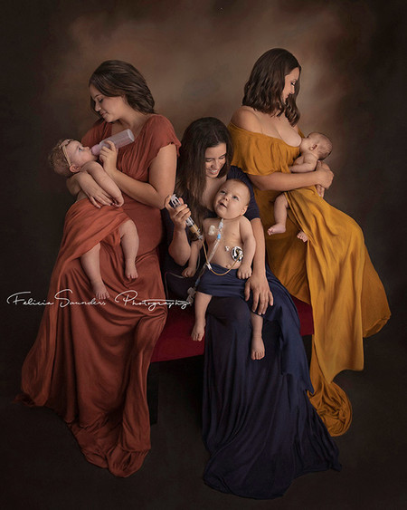 Esta imagen refleja el amor de una madre alimentando a su bebé sin importar cómo: con lactancia materna, biberón o sonda