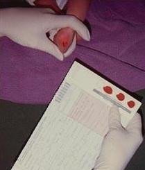 Fenilcetonuria, un trastorno metabólico