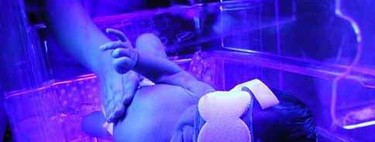 Bililuces: tratamiento para la ictericia