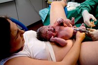 El 72% de las embarazadas pedirían la epidural al ir a parir