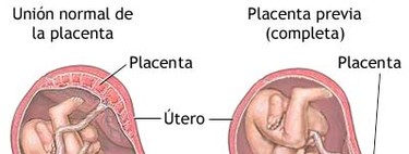 Qué es la placenta