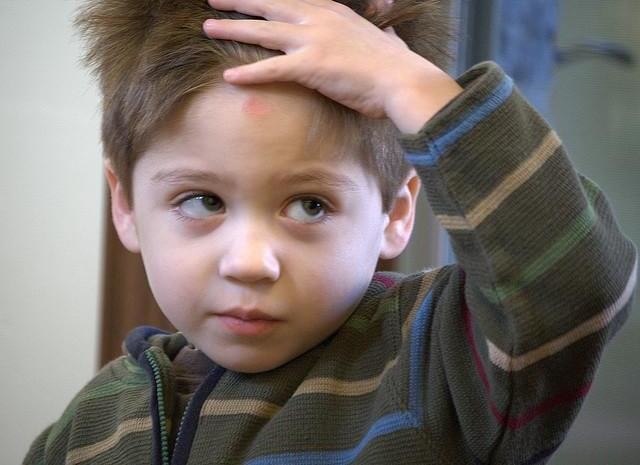 golpes en la cabeza niños y fiebre