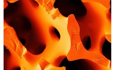 Este nuevo cemento a prueba de fracturas se ha inspirado en los erizos de mar