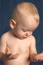 Angioma en niños