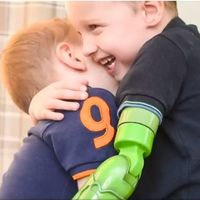El emotivo primer abrazo entre dos hermanos, después de que a uno de ellos le colocaran una prótesis funcional