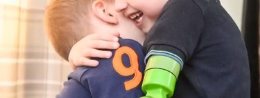 El emotivo primer abrazo entre dos hermanos, después de que a uno de ellos le colocaran una prótesis funcional