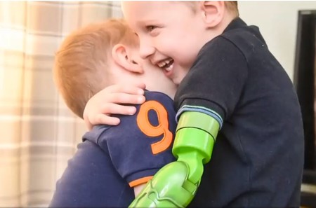 El emotivo primer abrazo entre dos hermanos, después de que a uno de ellos le colocaran una prótesis funcional