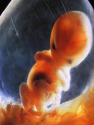 Éxito de una técnica pionera en cirugía fetal de espina bífida