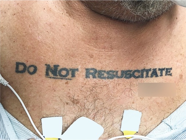 Do Not Resucitate