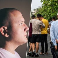 Durante años culpamos al estrés de la calvicie sin entender el motivo. La ciencia acaba de encontrar el eslabón perdido