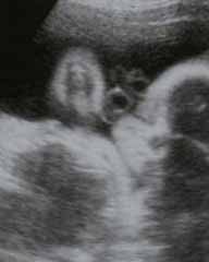 La imagen de Jesús en una ecografía