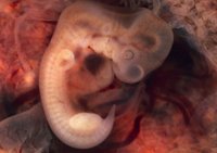 Anestesia para el feto cuando se practique un aborto