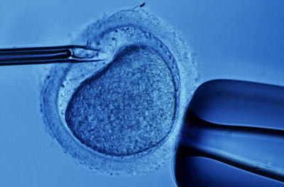 in-vitro