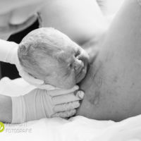 "El nacimiento de la cabeza": impactante serie de fotos del parto cuando solo ha salido la cabeza del bebé