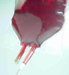 Pérdidas de sangre en el parto, la causa más común de muerte