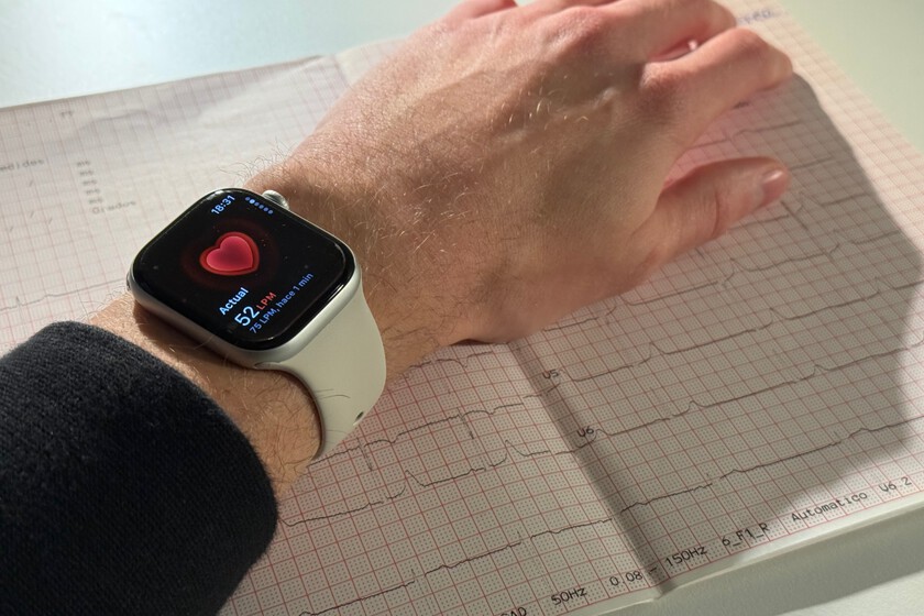 El 57% de los pacientes se sentían bien. El Apple Watch descubrió un problema grave que los chequeos médicos pasaron por alto