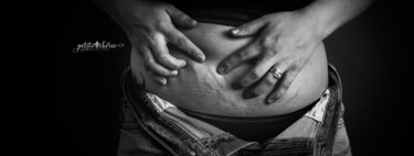 "Tus imperfecciones son perfectas", el precioso proyecto fotográfico que celebra el cuerpo postparto