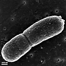 Microorganismos que reviven tras 100.000 años de hibernación