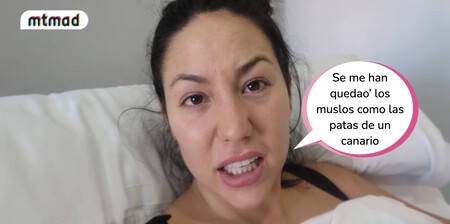 Steisy se somete a una macro-liposucción: se ha quedado como un rulo de kebab después de un sábado noche