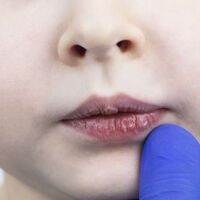 Labios secos y agrietados en niños, una condición muy habitual en invierno: así debemos tratarlos y cuidarlos