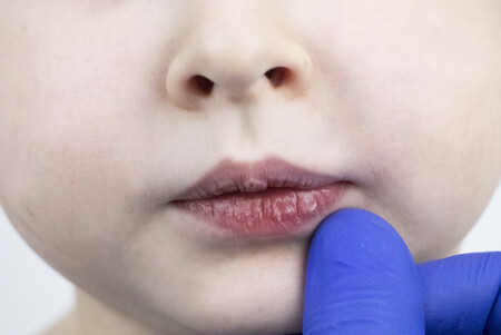 Labios secos y agrietados en niños, una condición muy habitual en invierno: así debemos tratarlos y cuidarlos