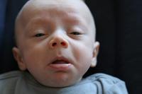 Moqueo, estornudos, picores, ¿tiene rinitis alérgica?