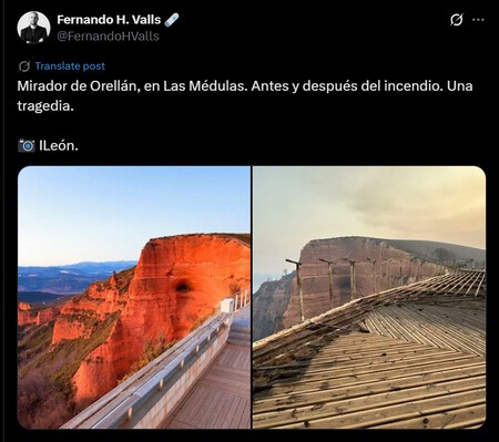 Medulas Antes Despues