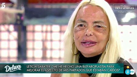 Este es el impactante rostro de Leticia Sabater tras someterse a su enésima cirugía estética