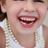 "¿Es normal que a mi hijo no se le haya caído todavía ningún diente?": a qué se debe la caída tardía de los dientes de leche y qué hacer 