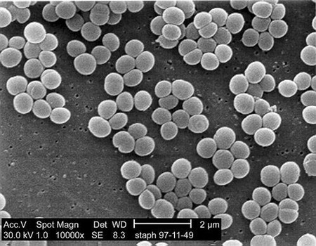 Superbacterias, ¿qué son y deben preocuparnos? (y II)