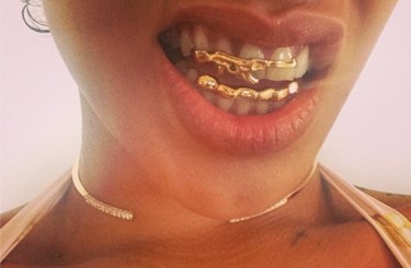 Grillz, la sonrisa del millón de dólares