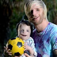 Sus padres lo abandonaron por su aspecto al nacer: la emotiva historia de superación de Jono Lancaster 