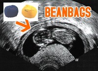 Ecografías curiosas: un toque de humor