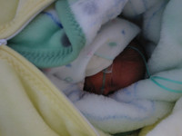 Nace la Federación Nacional de Asociaciones de Prematuros en España