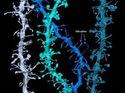 Imágenes de lo que les pasa a las neuronas al dormir: adelgazan