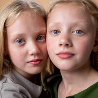 Los gemelos idénticos podrían no ser tan idénticos como se pensaba, de acuerdo con un nuevo estudio