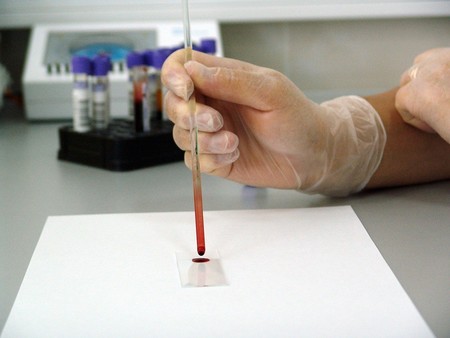 Un nuevo test podría detectar hasta siete tipos de cáncer con sólo una muestra de sangre