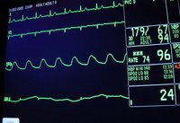 Más cerca la prestación para los padres con hijos gravemente enfermos