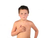 Un medicamento experimental para el sarampión obtiene buenos resultados probado en animales 