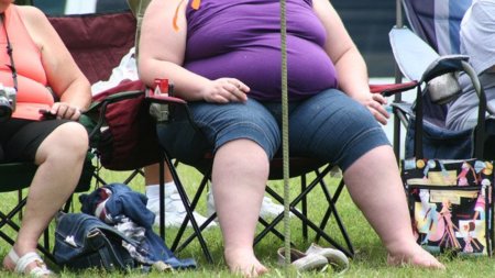 Distorsión de la imagen corporal: también un problema de obesos