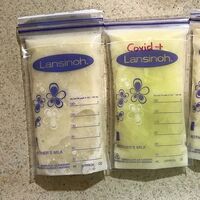 Una madre lactante muestra cómo su leche se ha vuelto verde al infectarse de Covid 