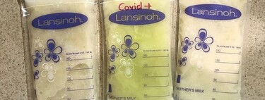 Una madre lactante muestra cómo su leche se ha vuelto verde al infectarse de Covid 