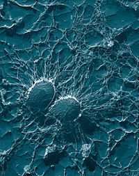 La muerte súbita podría estar relacionada con bacterias, según un estudio